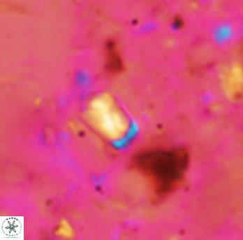 Calcivascularis cassidyi 1591