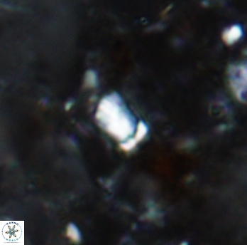 Calcivascularis cassidyi 1592