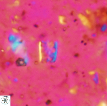 Calcivascularis cassidyi 1594