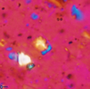 Calcivascularis cassidyi 1595