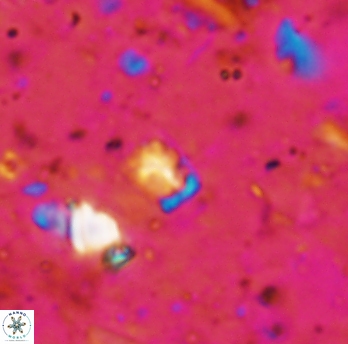 Calcivascularis cassidyi 1595