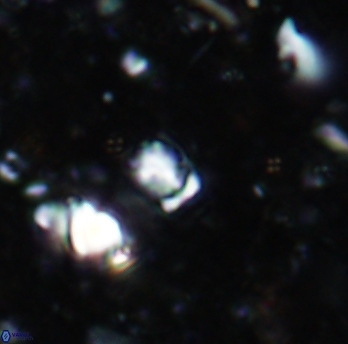 Calcivascularis cassidyi 1596