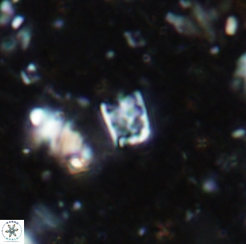 Calcivascularis cassidyi 1597