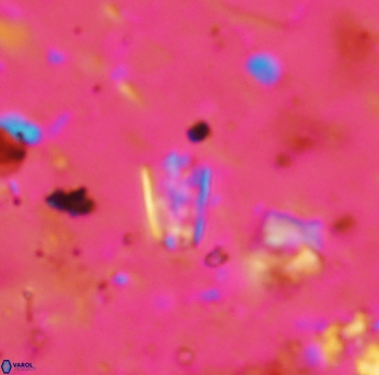 Calcivascularis cassidyi 1600