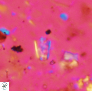Calcivascularis cassidyi 1600