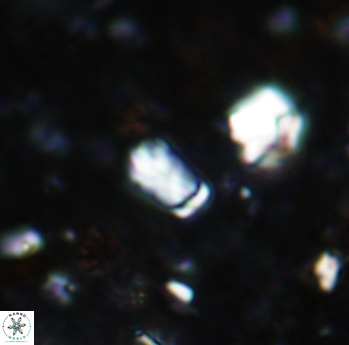 Calcivascularis cassidyi 1602