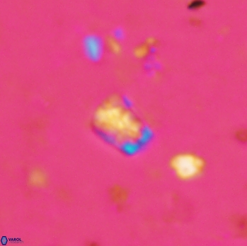 Calcivascularis cassidyi 1611