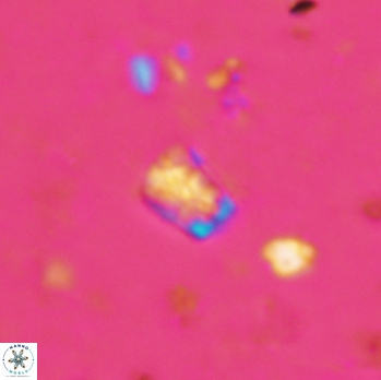 Calcivascularis cassidyi 1611