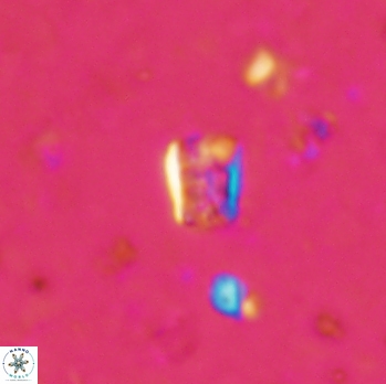 Calcivascularis cassidyi 1612