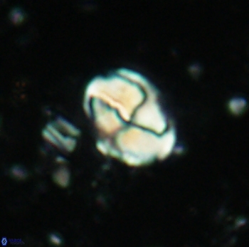 Calculites ovalis 4747