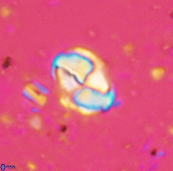 Calculites ovalis 4748