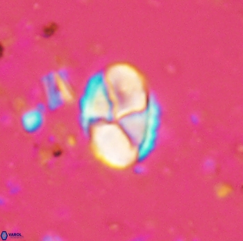 Calculites ovalis 4749