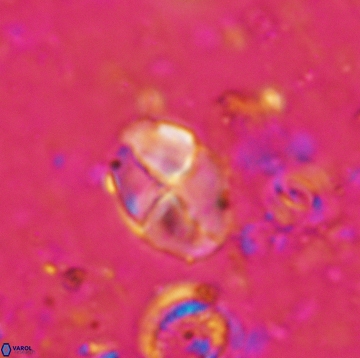 Calculites ovalis 5474