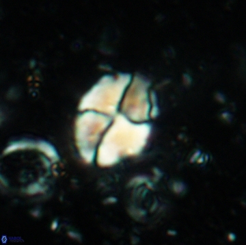 Calculites ovalis 5476