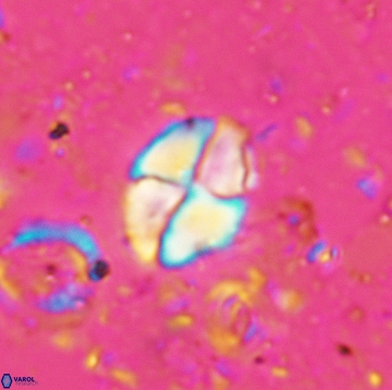 Calculites ovalis 5477