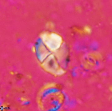 Calculites ovalis 5478