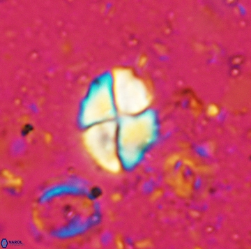 Calculites ovalis 5473