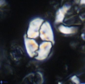 Calculites koilos 11788