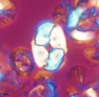 Calculites koilos 11790