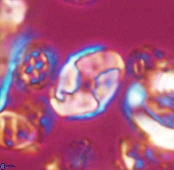 Calculites koilos 11794