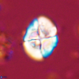 Calculites ovalis 15743