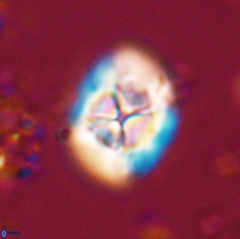 Calculites ovalis 15744