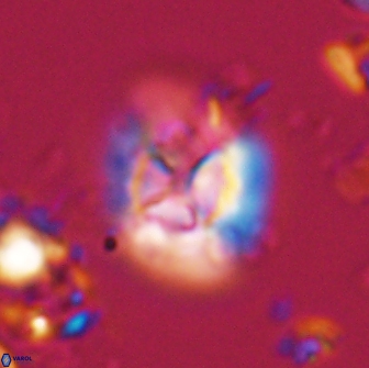 Calculites ovalis 15747