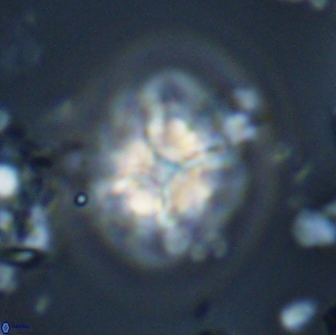 Calculites ovalis 15755