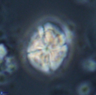 Calculites ovalis 15756