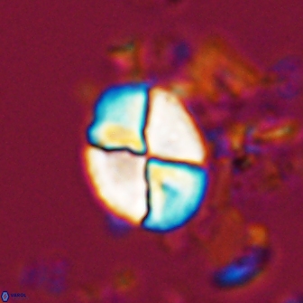 Calculites ovalis 18211