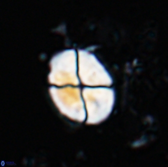 Calculites ovalis 18212