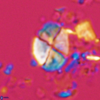 Calculites ovalis 18215