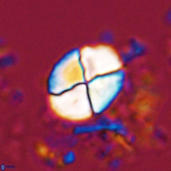 Calculites ovalis 18217