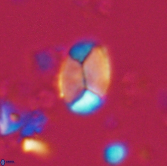 Calculites obscurus 15646