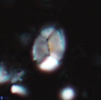 Calculites obscurus 15647