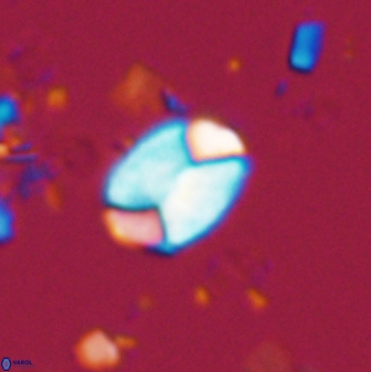 Calculites obscurus 15649