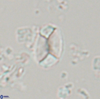 Calculites obscurus 15650