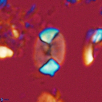 Calculites obscurus 16749