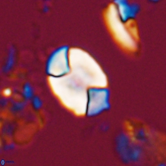 Calculites obscurus 16750