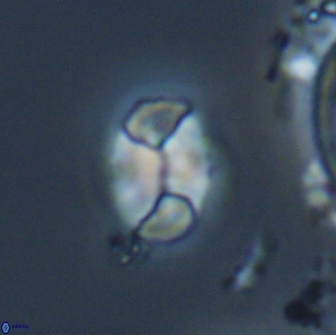 Calculites obscurus 16774