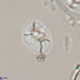 Calculites obscurus 16771