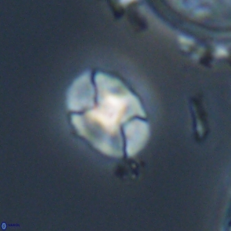 Calculites obscurus 16773