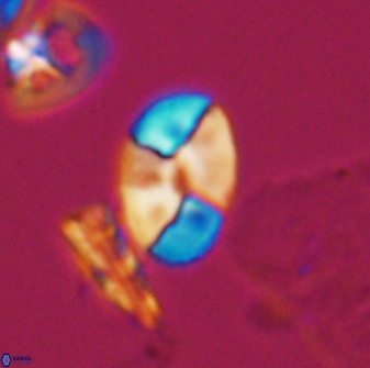 Calculites obscurus 10014