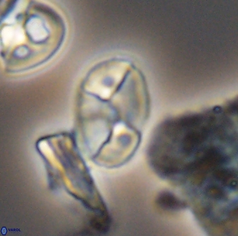 Calculites obscurus 10019