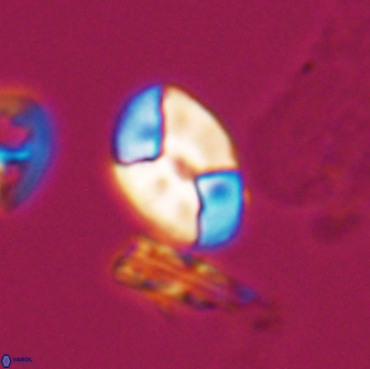 Calculites obscurus 10013