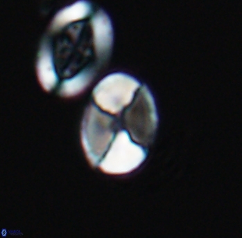 Calculites obscurus 10155