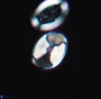 Calculites obscurus 10157