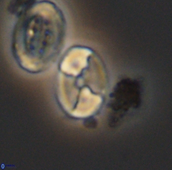 Calculites obscurus 10161