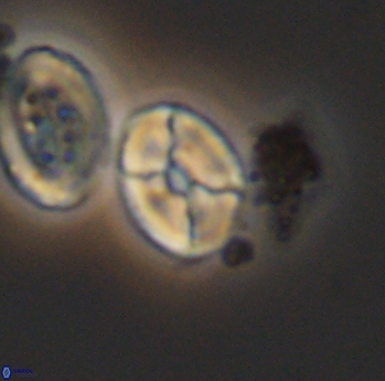 Calculites obscurus 10162