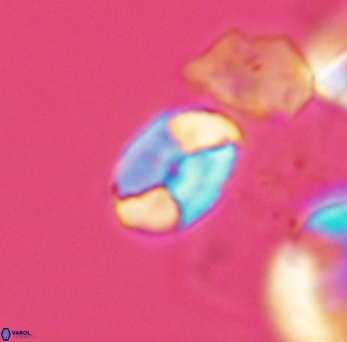 Calculites obscurus 3862